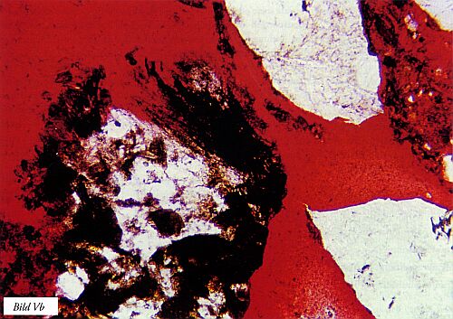 Bild V. Exempel på omvandlingar a) sekundära mineral som bildats bl a utefter kornfogar i granit och försvagat denna samt b) fina korn från stenmjöl som gjutits in i rödfärgad härdplast. Kornet tv innehåller lermineral (omvandlingsprodukt) och sönderfaller. Förstoringar ca 50 resp 100 gånger. Tunnslip. Bild b) i vanligt icke polariserat ljus.